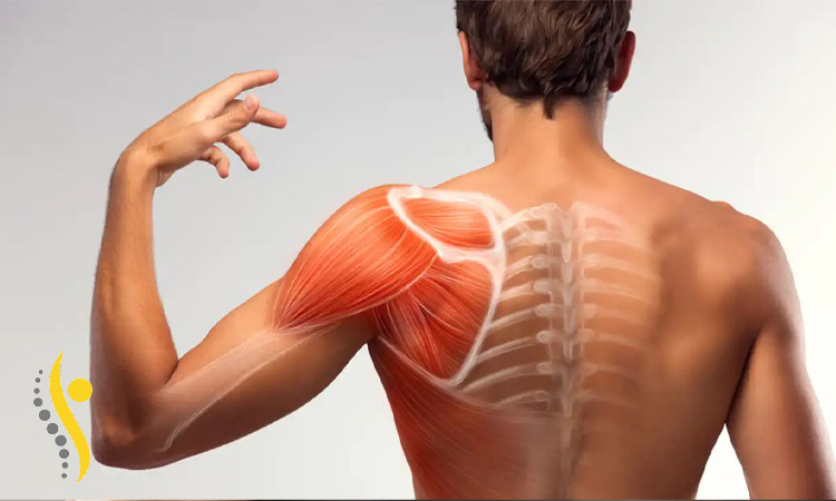 آسیب های شایع شانه