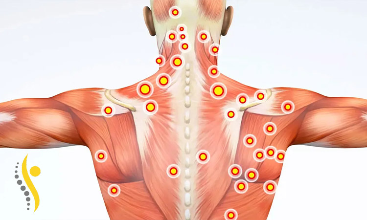 تریگر پوینت به چه روش هایی انجام میشود