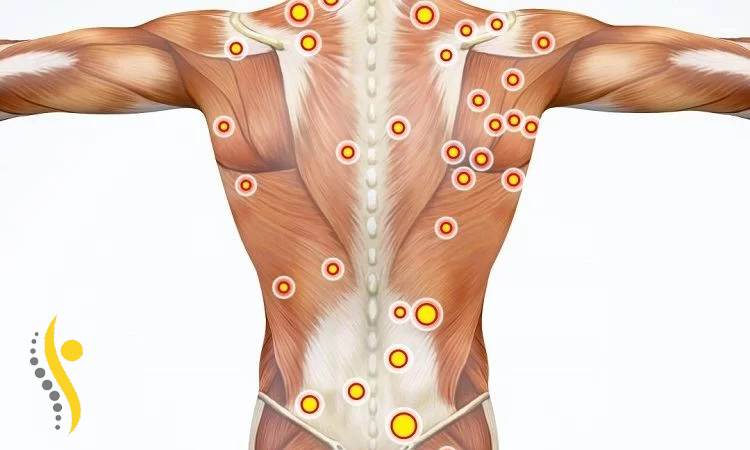 تریگر پوینت چیست