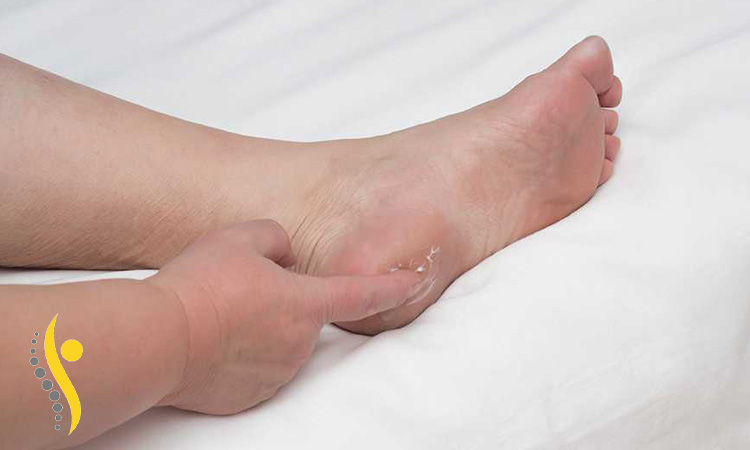 خار پاشنه چیست