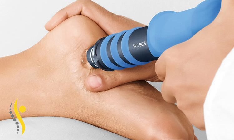 شاک ویو تراپی