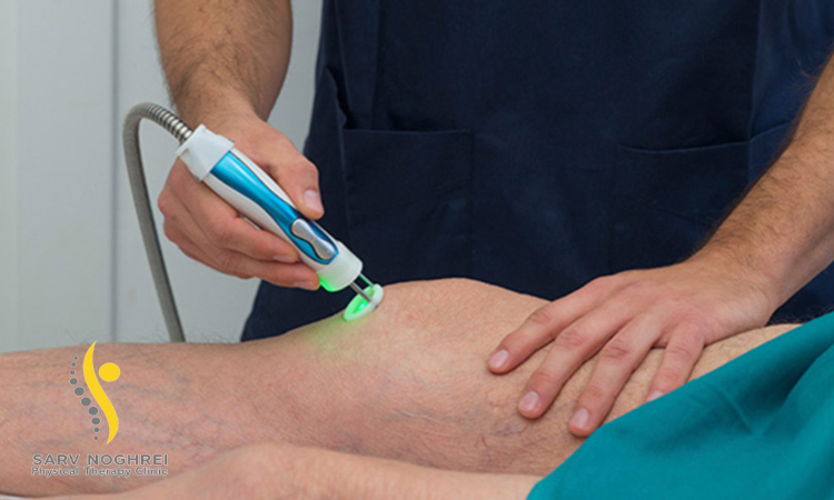 فیزیوتراپی پارگی رباط های صلیبی