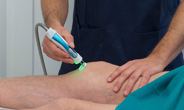 فیزیوتراپی پارگی رباط های صلیبی