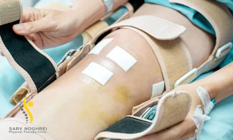 مراحل فیزیوتراپی ترمیم تاندون