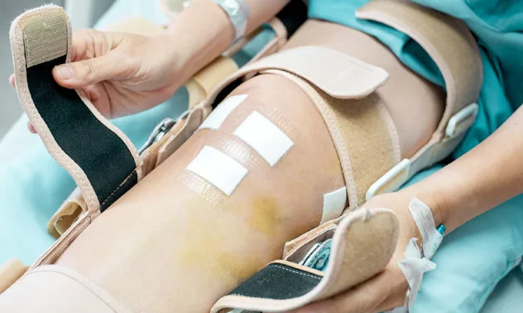 مراحل فیزیوتراپی ترمیم تاندون