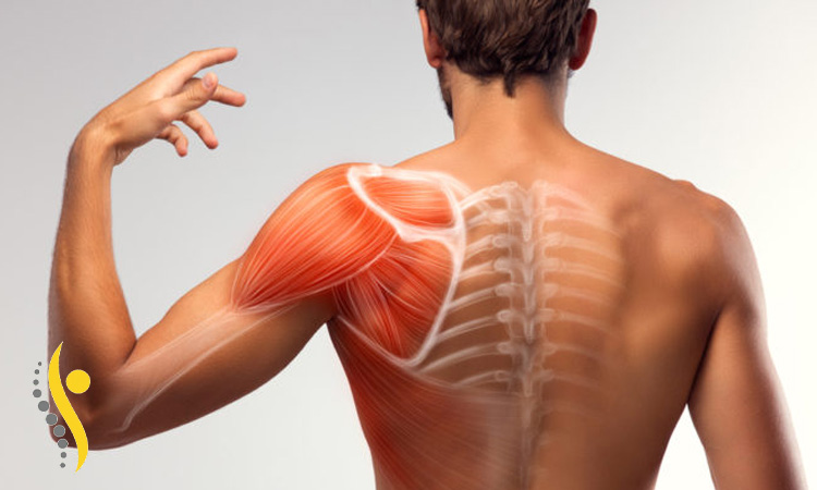 ساختار شانه