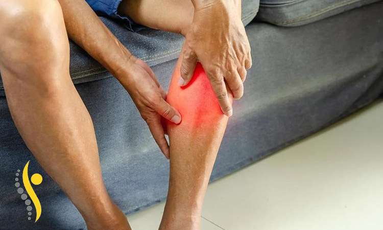 کشیدگی تاندون