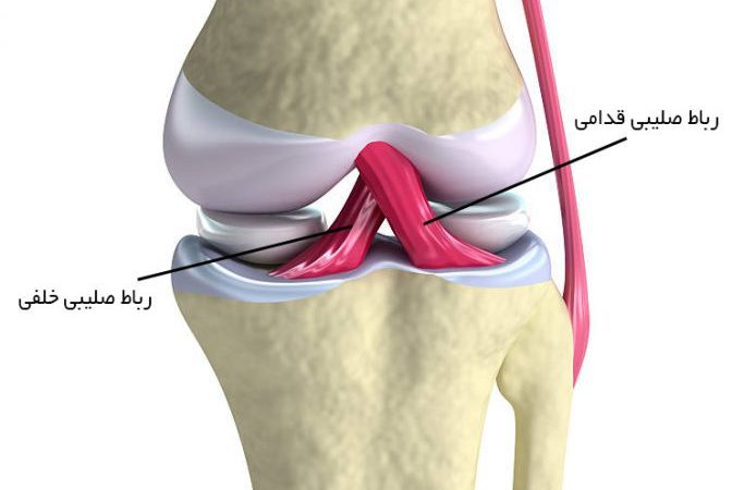 نقاهت پارگی رباط صلیبی